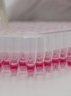 Southampton is a Centre of Excellence for the Leukaemia & Lymphoma Research charity, helping to improve treatment and diagnosis for patients in the UK.